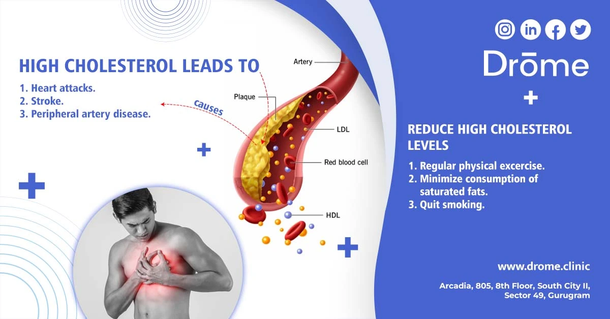 hyperlipidemia-high-cholesterol