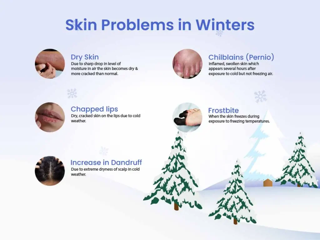 skin-condition-in-winters