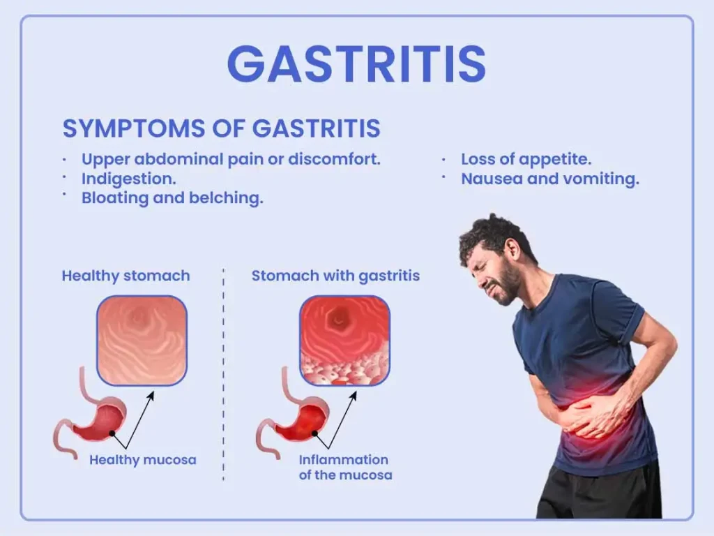 gastritis