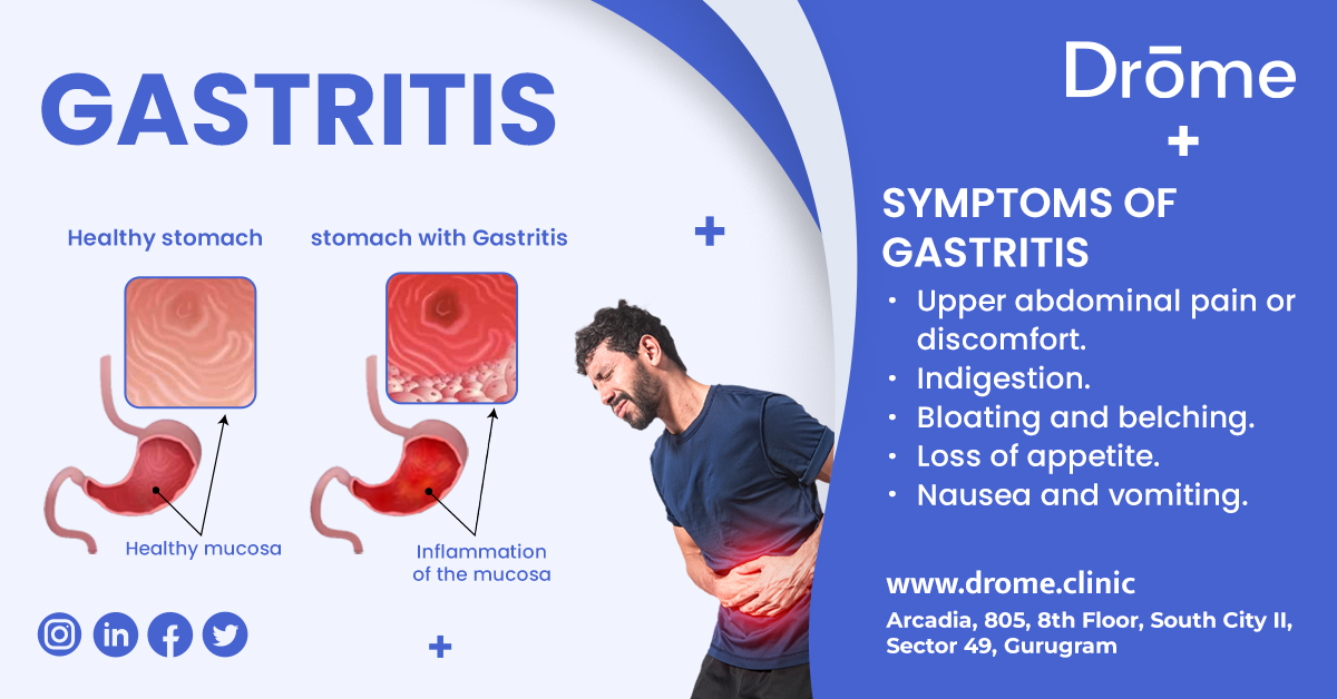 Gastritis 2023: How to Spot, Treat, and Prevent