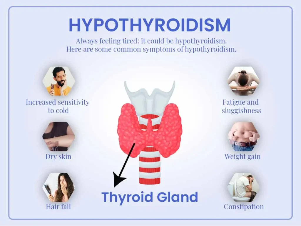 hypothyroidism