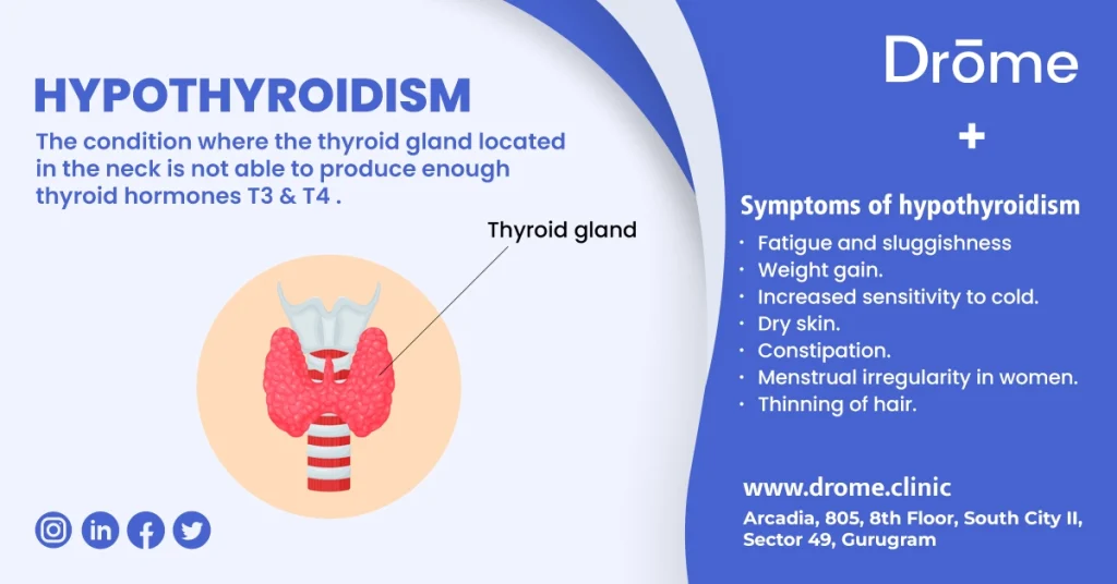 hypothyroidism-symptoms