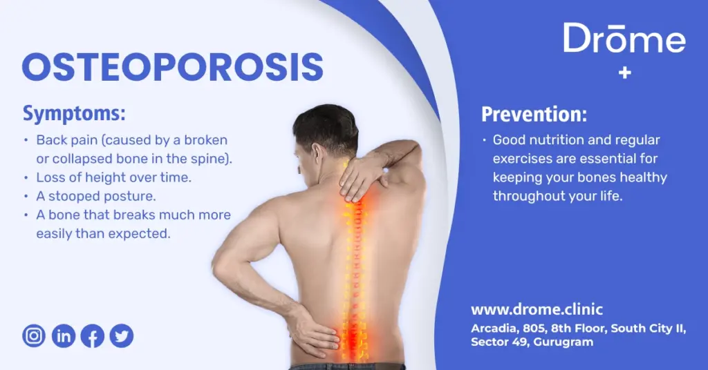 Osteoporosis-symptoms-prevention