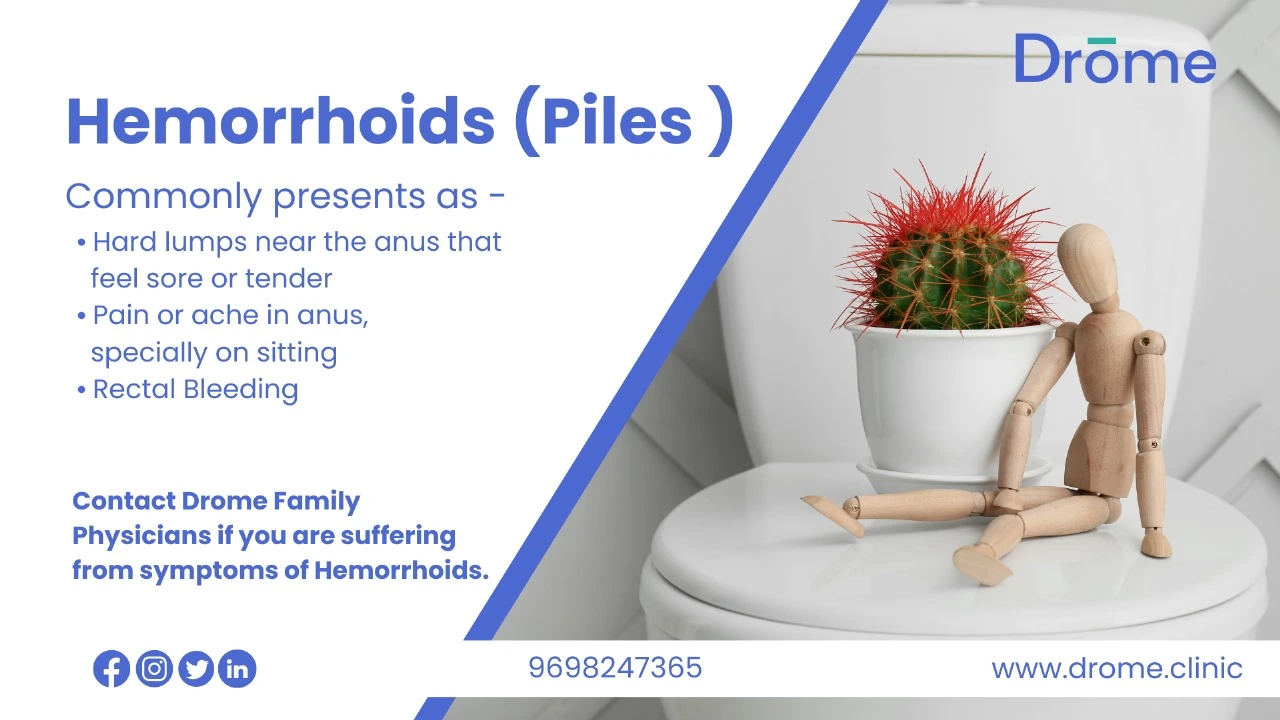 Hemorrhoids: Cause, Symptoms and Prevention