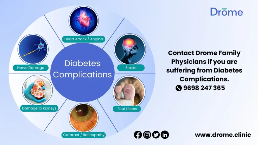 complication-of-diabetes